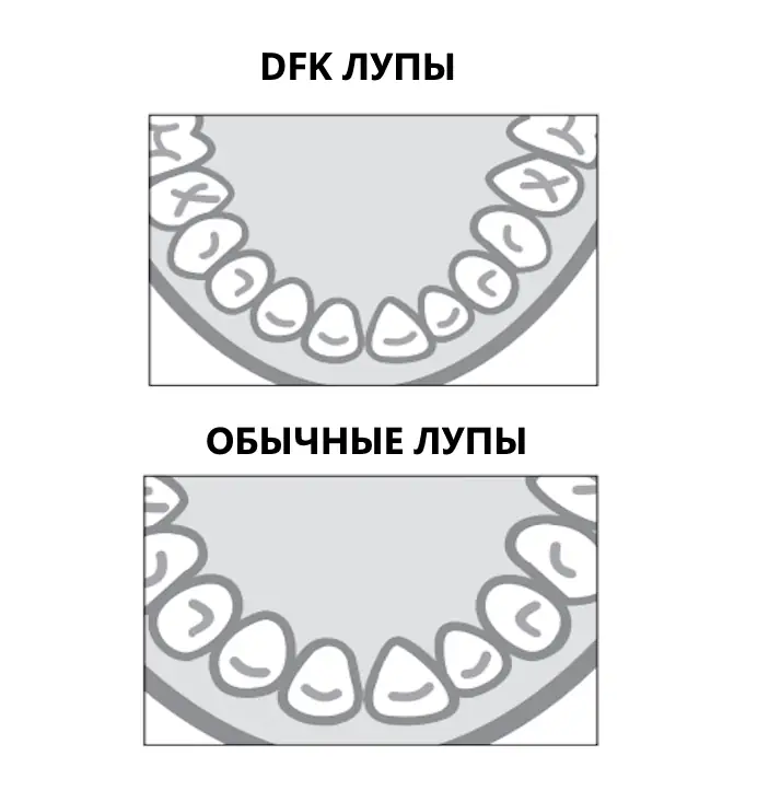 Лупы обладают широким углом обзора